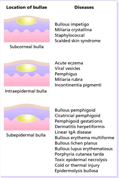 Bullous Diseases | Plastic Surgery Key