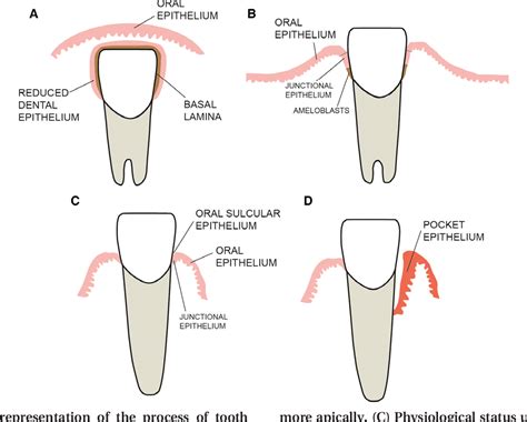 Figure 1 from Development of the gingival sulcus at the time of tooth eruption and the influence ...