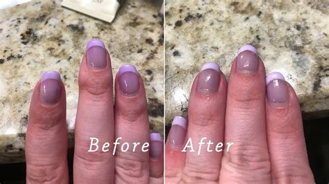 How To Remove Hair Dye From Nails | Renew Physical Therapy