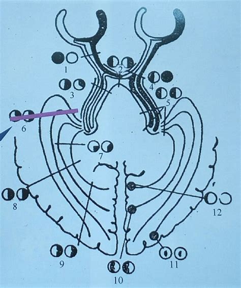 1. Optic nerve: blind ipsilateral eye, and normal contralateral eye; 2.... | Download Scientific ...