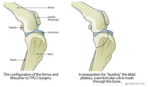 Cranial Cruciate Ligament Repair: Tibial Plateau Leveling Osteotomy (TPLO) | VCA Animal Hospital