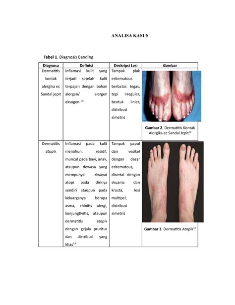 DKA - Diagnosis Banding - ANALISA KASUS Tabel 1. Diagnosis Banding Diagnosa Definisi Deskripsi ...