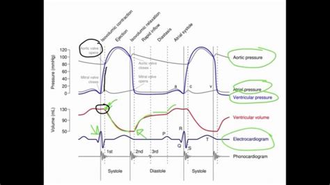 Wiggers Diagram Explained