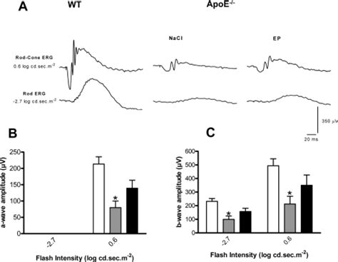 CD36 plays an important role in the clearance of oxLDL and associated age-dependent sub-retinal ...