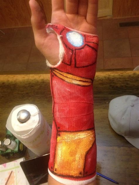 Iron Man Cast Turns a Broken Wrist Into a Good Thing | Fanboy Fashion