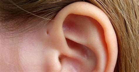 Lumps, Nodules and Cysts Around the Ears - The Clifford Clinic