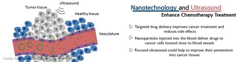 Health Tip on Focused Ultrasound and Microbubbles Improve Chemotherapy ...