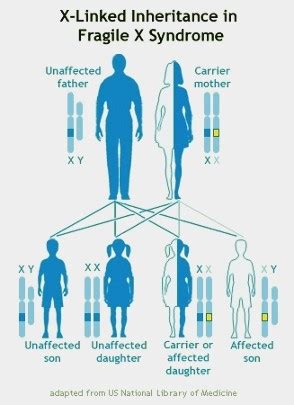 What Causes Fragile X Syndrome? A single gene shuts down.