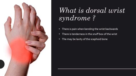 Dorsal Wrist Syndrome