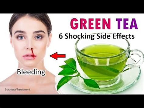 GREEN TEA | 6 Side Effects of Drinking Green Tea | 5-Minute Treatment ...