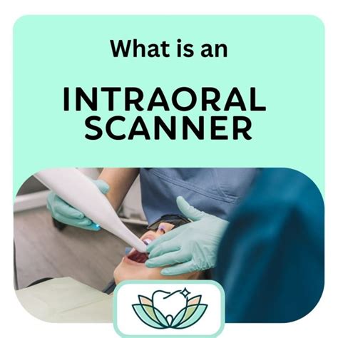 What is an intraoral scanner and why do we use them? | Tranquility ...