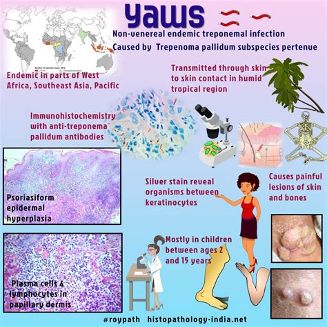 Pin on Pathology of Infectious Diseases