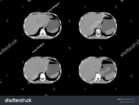 Chest Ct Scan Mri Images Stock Photo 2048053472 | Shutterstock