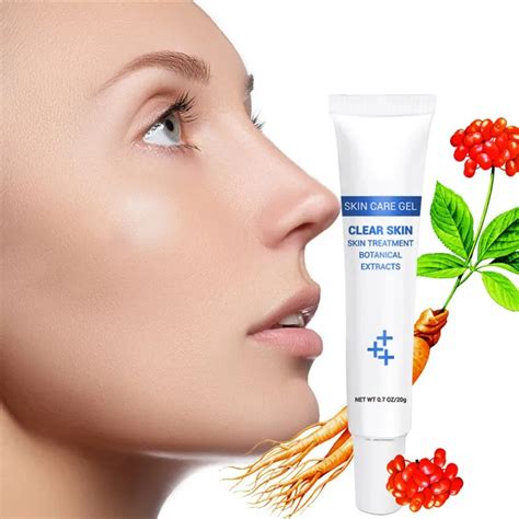 Blackhead Cleaning Treatment Gel Cream Blackhead Remover Whelk Spots ...