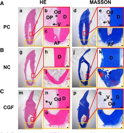 Figure 2 from Regenerative Endodontics by Cell homing-a review of ...