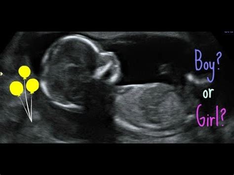 Baby Ultrasound and Gender Reveal - YouTube