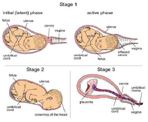 Stages of Labor | Stages of labor, Midwifery, Student midwife