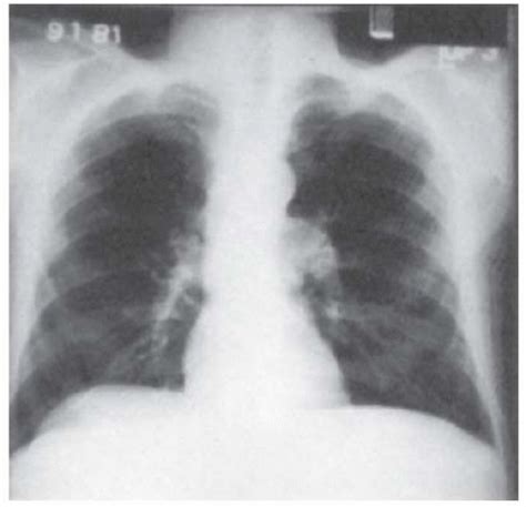 Radiographic Examinations | Thoracic Key