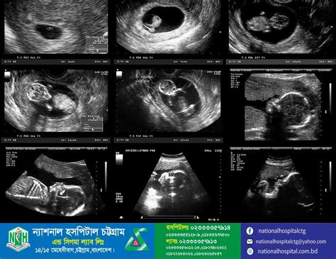 Anomaly Scan Price in Bangladesh