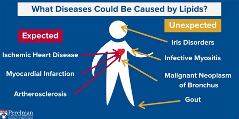 Lipids model how to explore for unexpected diseases | Penn Today