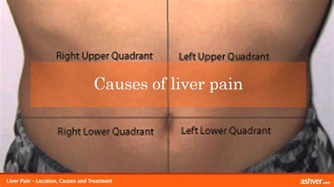 Liver Pain - Location, Causes and Treatment - YouTube