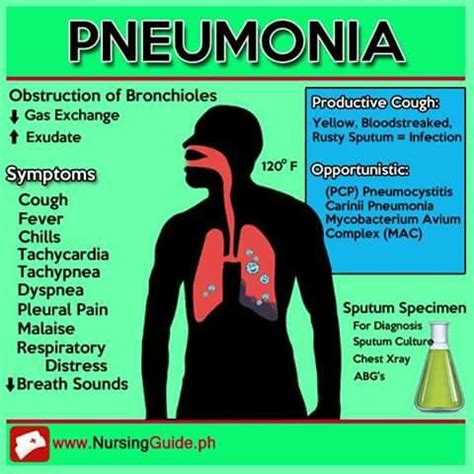 Pneumonia #Pneumonia #RespiratoryCareStore. For more information about ...