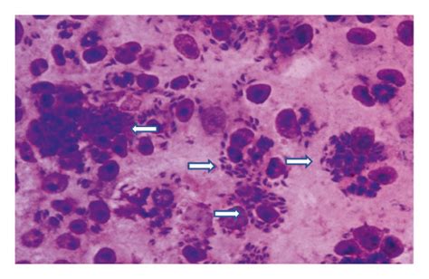 Microscopic observation of intracellular parasite at 24 hours and 48 ...