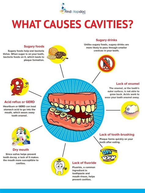 What are Cavities? What Causes Cavities? [Infographic]