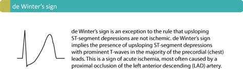 T-waves in ischemia: hyperacute, inverted (negative), Wellen's sign & de Winter's sign – ECG ...