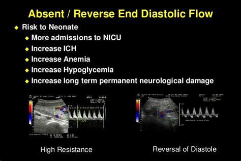 Color doppler in fetal hypoxia