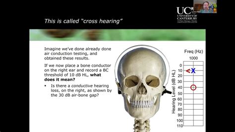 Introduction to Clinical Masking in Audiology - YouTube