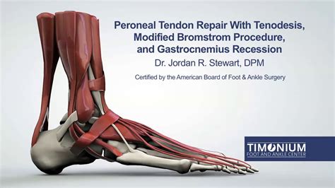 Peroneal Tendon Repair With Tenodesis Modified Bromstrom Procedure and Gastrocnemius Recession ...