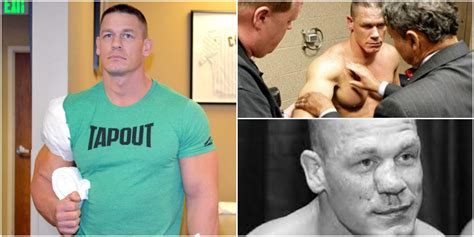 Every Major Injury Of John Cena's WWE Career, Explained