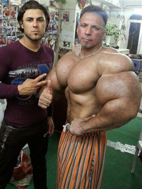 This Guy Uses Way Too Much Synthol (20 pics)