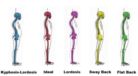 The Importance of Good Posture for a Healthy Spine | Wisdom Confidential