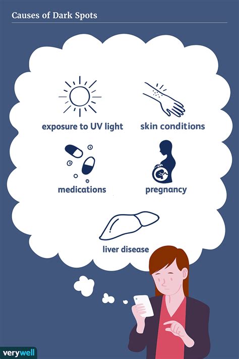 Dark Spots: Causes, Diagnosis, and Treatment