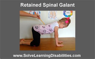 Retained Spinal Galant Reflex - Solve Learning Disabilities