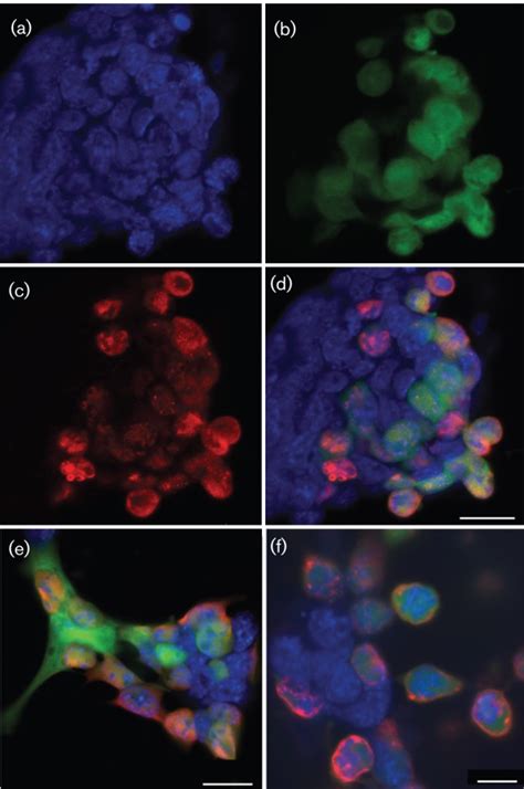 Confocal microscopy of HSV-1-infected mES cells at 24 h p.i. GFP... | Download Scientific Diagram