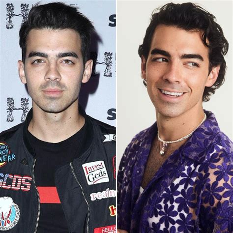 Did Joe Jonas Get Plastic Surgery? See Before-and-After Photos of the ...