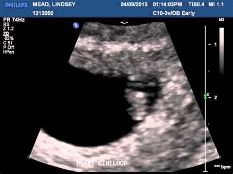 7 week ultrasound- heartbeat - YouTube