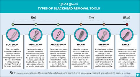 The Best Blackhead Removal Tools & Treatments for 2022