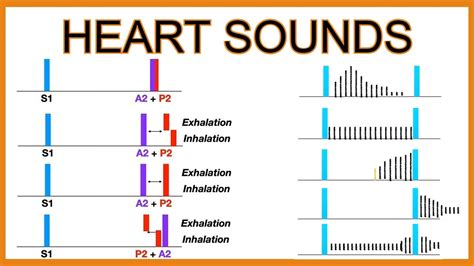 Heart Sounds (Murmurs and Splitting) - YouTube