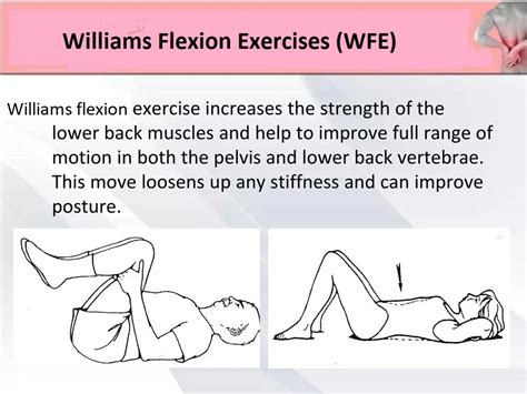 Williams Flexion Exercise (WFE) - For Low Back Pain