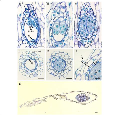 Polyembryony and seed coat development in Cypripedium japonicum. a-c.... | Download Scientific ...