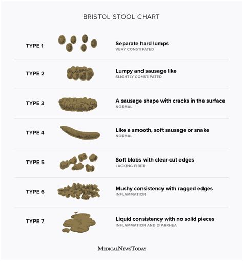 Bristol Stool scale: Stool types and what they mean