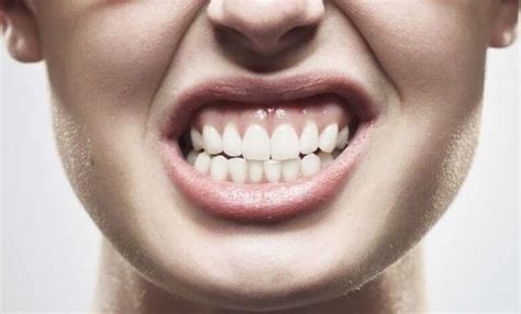 Teeth Clenching - Headaches & Anxiety | What You Need to Know