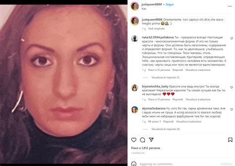 L'influencer fiera dei suoi zigomi enormi: le foto prima e dopo gli ...