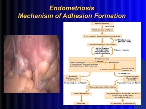 Initiation and maintainence of endometriosis