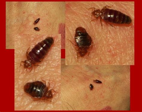 What Do Bed Bugs Look Like? Over 50 Pictures | Debedbug