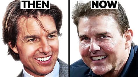 Tom Cruise: Why His Face Looks Different | Plastic Surgery Analysis - Oasis Medical Aesthetics